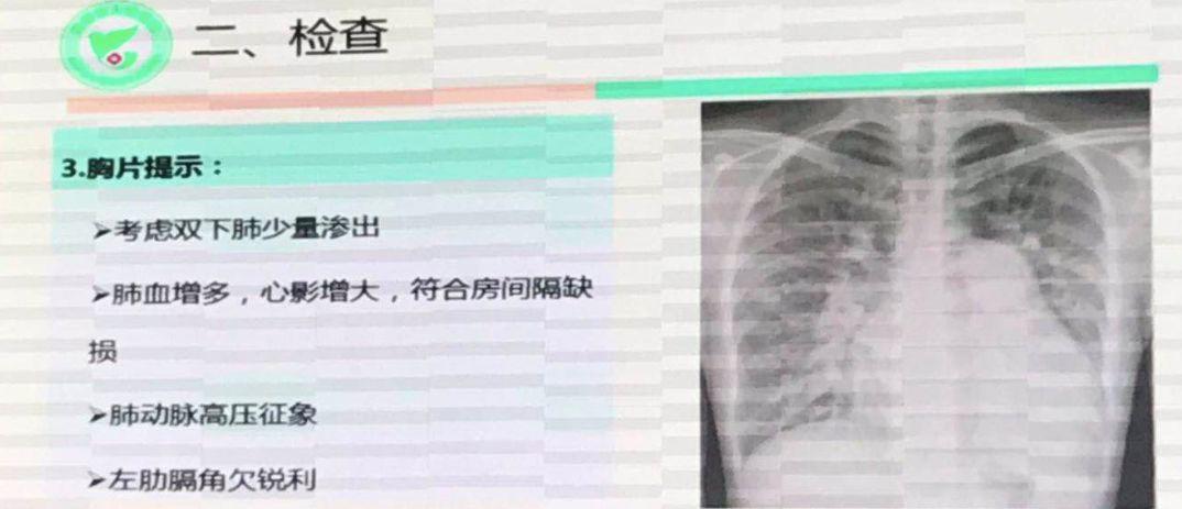 刚刚，中国完成首例AI+5G心脏手术！2分钟AI建模，400公里远程协作“补心”